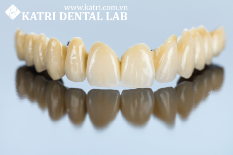 Khi mất thẻ bảo hành, khách hàng cần làm gì?