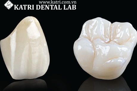 Khi cần bảo hành, khách hàng cần làm gì?